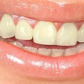 стоматология royal smile изображение 6 на проекте zuzino24.ru