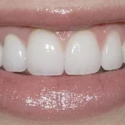стоматология royal smile изображение 2 на проекте zuzino24.ru